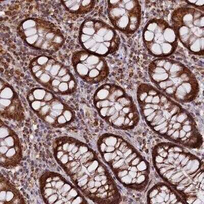 Immunohistochemistry-Paraffin: DUS3L Antibody [NBP1-84043] - Staining of human rectum shows strong cytoplasmic positivity in glandular cells.