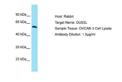 Western Blot: DUS3L Antibody [NBP2-87308] - Host: Rabbit. Target Name: DUS3L. Sample Type: OVCAR-3 Whole Cell lysates. Antibody Dilution: 1.0ug/ml
