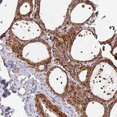 Immunohistochemistry-Paraffin DUS4L Antibody