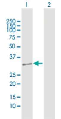 Western Blot: DUS4L Antibody [H00011062-D01P] - Analysis of DUS4L expression in transfected 293T cell line by DUS4L polyclonal antibody.Lane 1: DUS4L transfected lysate(35.80 KDa).Lane 2: Non-transfected lysate.