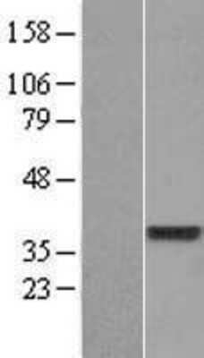 Western Blot: DUS4L Overexpression Lysate (Adult Normal) [NBP2-04914] Left-Empty vector transfected control cell lysate (HEK293 cell lysate); Right -Over-expression Lysate for DUS4L.