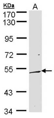 Western Blot DUSP10 Antibody