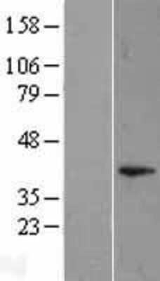 Western Blot: DUSP11 Overexpression Lysate (Adult Normal) [NBL1-10047] Left-Empty vector transfected control cell lysate (HEK293 cell lysate); Right -Over-expression Lysate for DUSP11.