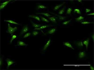 Immunocytochemistry/Immunofluorescence: DUSP12 Antibody [H00011266-D01P] - Analysis of antibody to DUSP12 on HeLa cell. Antibody concentration 20 ug/ml.