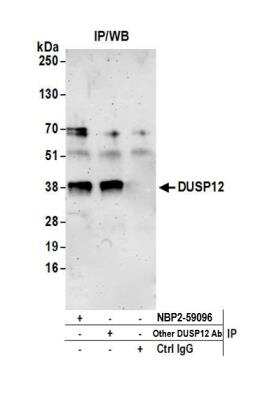 Immunoprecipitation: DUSP12 Antibody [NBP2-59096] - Detection of human DUSP12 by western blot of immunoprecipitates. Samples: Whole cell lysate (0.5 or 1.0 mg per IP reaction; 20% of IP loaded) from 293T cells prepared using NETN lysis buffer. Antibodies: Affinity purified rabbit anti-DUSP12 antibody NBP2-59096 used for IP at 20 ul per reaction. DUSP12 was also immunoprecipitated by another rabbit anti-DUSP12 antibody. For blotting immunoprecipitated DUSP12, NBP2-59096 was used at 1:100. Detection: Chemiluminescence with an exposure time of 3 minutes.