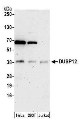 Western Blot: DUSP12 Antibody [NBP2-59096] - Samples: Whole cell lysate (15 ug) from HeLa, 293T, and Jurkat cells prepared using NETN lysis buffer. Antibody: Affinity purified rabbit anti-DUSP12 antibody NBP2-59096 used for WB at 1:1000. Detection: Chemiluminescence with an exposure time of 3 minutes.