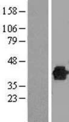 Western Blot DUSP12 Overexpression Lysate