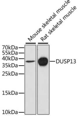 Western Blot: DUSP13 Antibody [NBP2-92793] - Analysis of extracts of various cell lines, using DUSP13 at 1:1000 dilution.Secondary antibody: HRP Goat Anti-Rabbit IgG (H+L) at 1:10000 dilution.Lysates/proteins: 25ug per lane.Blocking buffer: 3% nonfat dry milk in TBST.Detection: ECL Basic Kit .Exposure time: 90s.