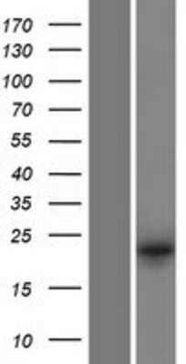 Western Blot: DUSP13 Overexpression Lysate (Adult Normal) [NBP2-07039] Left-Empty vector transfected control cell lysate (HEK293 cell lysate); Right -Over-expression Lysate for DUSP13.