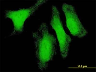 Immunocytochemistry/Immunofluorescence: DUSP14 Antibody (4B5-E6) [H00011072-M02] - Analysis of monoclonal antibody to DUSP14 on HeLa cell . Antibody concentration 10 ug/ml.