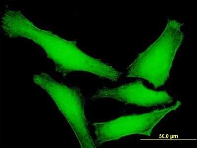 Immunocytochemistry/Immunofluorescence: DUSP14 Antibody [H00011072-B01P] - Analysis of purified antibody to DUSP14 on HeLa cell. (antibody concentration 10 ug/ml)