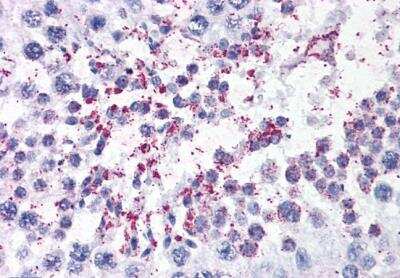 Immunohistochemistry-Paraffin DUSP14 Antibody