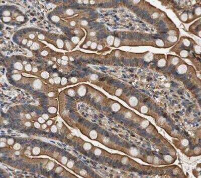 Immunohistochemistry-Paraffin: DUSP14 Antibody [NBP1-81046] - Staining of human small intestine shows strong cytoplasmic and membranous positivity in glandular cells.