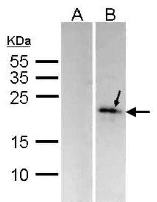 Western Blot: DUSP14 Antibody [NBP2-16237] - Western Blot analysis of MKP-6 expression in transfected 293T cell line (20ug of whole cell ltsate) A: Non-transfected lysate. B: MKP-6 transfected lysate. 12% SDS PAGE gel, diluted at 1:1000.