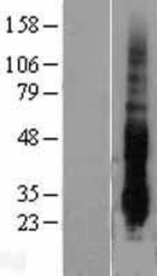 Western Blot: DUSP14 Overexpression Lysate (Adult Normal) [NBL1-10049] Left-Empty vector transfected control cell lysate (HEK293 cell lysate); Right -Over-expression Lysate for DUSP14.