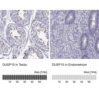 <b>Orthogonal Strategies Validation. </b>Immunohistochemistry-Paraffin: DUSP15 Antibody [NBP2-57320] - Staining in human testis and endometrium tissues using anti-DUSP15 antibody. Corresponding DUSP15 RNA-seq data are presented for the same tissues.