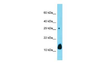 Western Blot: DUSP15 Antibody [NBP2-84828] - Host: Rabbit. Target Name: Dusp15. Sample Type: Mouse Kidney lysates. Antibody Dilution: 1.0ug/ml