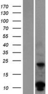 Western Blot: DUSP15 Overexpression Lysate (Adult Normal) [NBP2-04954] Left-Empty vector transfected control cell lysate (HEK293 cell lysate); Right -Over-expression Lysate for DUSP15.
