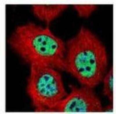 Immunocytochemistry/Immunofluorescence: DUSP16 Antibody [NBP1-33747] - Paraformaldehyde-fixed A431, using DUSP16 (NBP1-33747) antibody (Green) at 1:500 dilution. Alpha-tubulin filaments were labeled with (Red) at 1:2000.