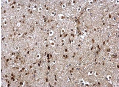 Immunohistochemistry-Paraffin: DUSP16 Antibody [NBP1-33747] - Paraffin-embedded mouse middle brain.  DUSP16 antibody [C2C3], C-term dilution: 1:500.