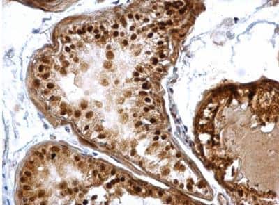 Immunohistochemistry-Paraffin: DUSP16 Antibody [NBP1-33747] - Paraffin-embedded mouse prostate.  DUSP16 antibody [C2C3], C-term dilution: 1:500.