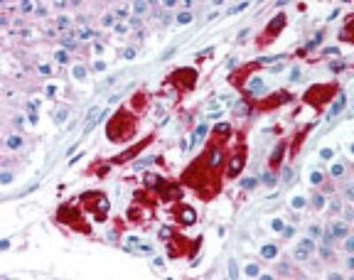 Immunohistochemistry-Paraffin DUSP16 Antibody