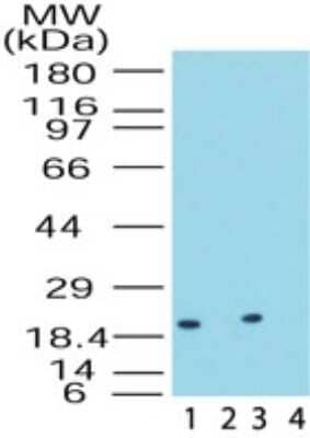 Western Blot: DUSP18 Antibody [NB100-56481] - Analysis of DUSP18 in rat testis lysate in the 1) absence and 2) presence of immunizing peptide and in human testis lysate in the 3) absence and 4) presence of immunizing peptide using this antibody at 0.5 ug/ml.