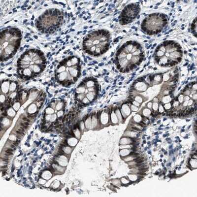 Immunohistochemistry-Paraffin DUSP19 Antibody - BSA Free