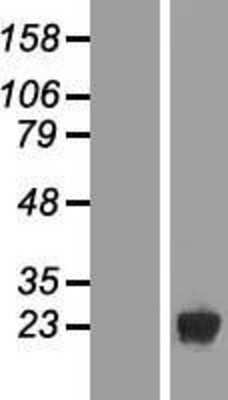Western Blot: DUSP19 Overexpression Lysate (Adult Normal) [NBP2-05748] Left-Empty vector transfected control cell lysate (HEK293 cell lysate); Right -Over-expression Lysate for DUSP19.