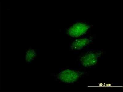 Immunocytochemistry/Immunofluorescence: DUSP22 Antibody [H00056940-B01P] - Analysis of purified antibody to DUSP22 on HeLa cell. (antibody concentration 10 ug/ml)