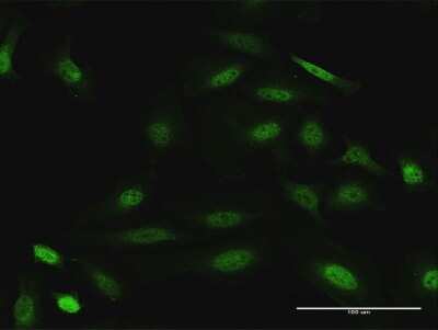 Immunofluorescence: DUSP22 Antibody [H00056940-D01P] - Analysis of antibody to DUSP22 on HeLa cell. Antibody concentration 10 ug/ml.
