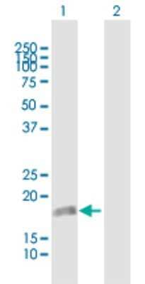 Western Blot: DUSP22 Antibody [H00056940-B01P] - Analysis of DUSP22 expression in transfected 293T cell line by DUSP22 polyclonal antibody.  Lane 1: DUSP22 transfected lysate(20.24 KDa). Lane 2: Non-transfected lysate.