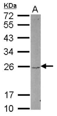 Western Blot: DUSP22 Antibody [NBP2-16239] - Sample (30 ug of whole cell lysate) A: HCT116 12% SDS PAGE gel, diluted at 1:1000.