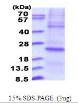 SDS-Page: DUSP22 Recombinant Protein [NBP2-51697] - 15% SDS Page (3 ug)