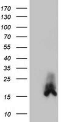 Western Blot: DUSP23 Antibody (3C10) [NBP2-01507] - HEK293T cells were transfected with the pCMV6-ENTRY control (Left lane) or pCMV6-ENTRY DUSP23 (Right lane) cDNA for 48 hrs and lysed. Equivalent amounts of cell lysates (5 ug per lane) were separated by SDS-PAGE and immunoblotted with anti-DUSP23.