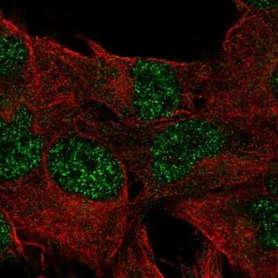 Immunocytochemistry/Immunofluorescence: DUSP23 Antibody [NBP2-58763] - Staining of human cell line SK-MEL-30 shows localization to nucleoplasm.