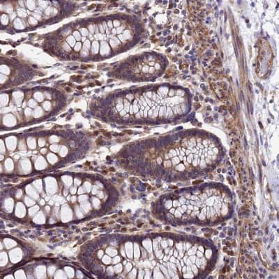 Immunohistochemistry-Paraffin: DUSP23 Antibody [NBP1-91855] - Staining of human colon shows moderate cytoplasmic positivity in glandular cells.