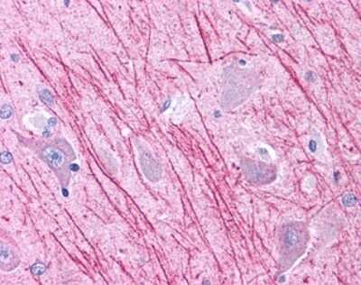 Immunohistochemistry-Paraffin: DUSP23 Antibody [NLS6803] - Analysis of anti-DUSP23 antibody with human brain, hippocampus.