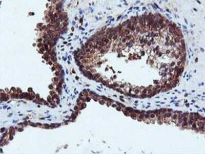 Immunohistochemistry: DUSP23 Antibody (OTI3C10) - Azide and BSA Free [NBP2-71976] - Staining of paraffin-embedded Human prostate tissue using anti-DUSP23 mouse monoclonal antibody.