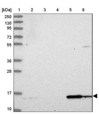 Western Blot: DUSP23 Antibody [NBP1-91855] - Lane 1: Marker  [kDa] 250, 130, 95, 72, 55, 36, 28, 17, 10.  Lane 2: Human cell line RT-4.  Lane 3: Human cell line U-251MG sp.  Lane 4: Human plasma (IgG/HSA depleted).  Lane 5: Human liver tissue.  Lane 6: Human tonsil tissue