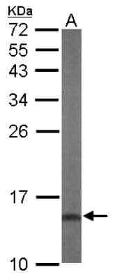 Western Blot: DUSP23 Antibody [NBP2-16240] - Sample (50 ug of whole cell lysate) A: Mouse Liver, 15% SDS PAGE gel, diluted at 1:1000.