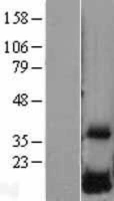 Western Blot: DUSP23 Overexpression Lysate (Adult Normal) [NBL1-10051] Left-Empty vector transfected control cell lysate (HEK293 cell lysate); Right -Over-expression Lysate for DUSP23.