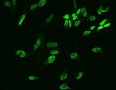 Immunocytochemistry/Immunofluorescence: DUSP26 Antibody [NBP3-06507] - Staining of DUSP26 in SHSY5Y cells. Cells were fixed with 4% PFA, permeabilzed with 0.1% Triton X-100 in PBS,blocked with 10% serum, and incubated with rabbit anti-Human DUSP26 polyclonal antibody (dilution ratio 1:200) at 4? overnight. Then cells were stained with the Alexa Fluor®488-conjugated Goat Anti-rabbit IgG secondary antibody (green). Positive staining was localized to Nucleus.