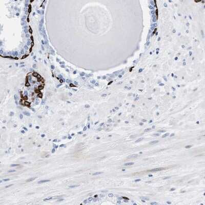 Immunohistochemistry: DUSP26 Antibody [NBP2-33880] - Staining of human prostate shows strong positivity in basal cells.