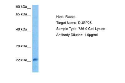 Western Blot: DUSP26 Antibody [NBP2-84833] - Host: Rabbit. Target Name: DUSP26. Sample Tissue: 786-0 Whole Cell lysates. Antibody Dilution: 1ug/ml