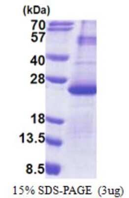 SDS-PAGE Recombinant Human DUSP26 His Protein