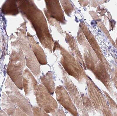 Immunohistochemistry-Paraffin DUSP27/DUPD1 Antibody - BSA Free