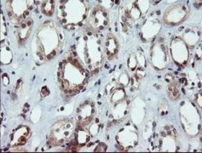 Immunohistochemistry: DUSP27/DUPD1 Antibody (OTI7E4) - Azide and BSA Free [NBP2-72503] - DUSP27/DUPD1 Antibody (7E4) Staining of paraffin-embedded Human Kidney tissue using anti-DUSP27 mouse monoclonal antibody.
