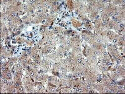Immunohistochemistry: DUSP27/DUPD1 Antibody (OTI7E4) - Azide and BSA Free [NBP2-72503] - DUSP27/DUPD1 Antibody (7E4) Staining of paraffin-embedded Human liver tissue using anti-DUSP27 mouse monoclonal antibody.