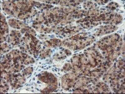 Immunohistochemistry: DUSP27/DUPD1 Antibody (OTI7E4) - Azide and BSA Free [NBP2-72503] - DUSP27/DUPD1 Antibody (7E4) Staining of paraffin-embedded Human pancreas tissue using anti-DUSP27 mouse monoclonal antibody.